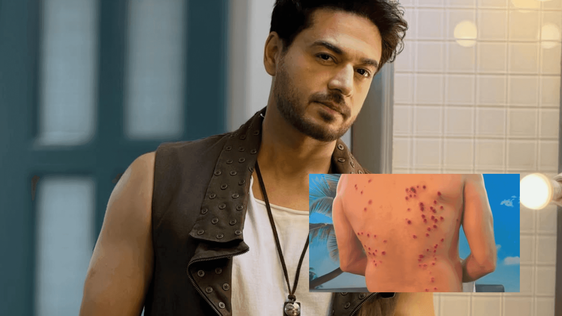 KKK 15: Gaurav Khanna Opens Up About Painful Stunt